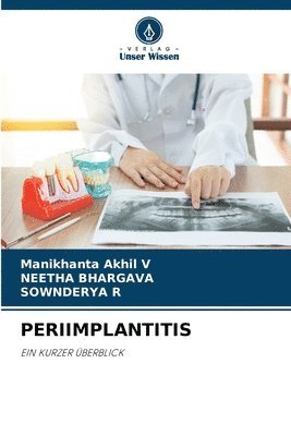 bokomslag Periimplantitis