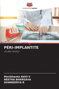 bokomslag Pri-Implantite