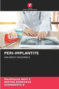bokomslag Peri-Implantite