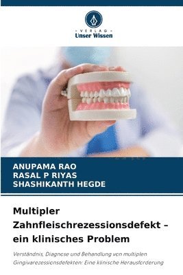 bokomslag Multipler Zahnfleischrezessionsdefekt - ein klinisches Problem