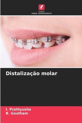 Distalizao molar 1