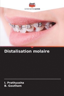 Distalisation molaire 1