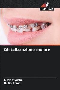 bokomslag Distalizzazione molare