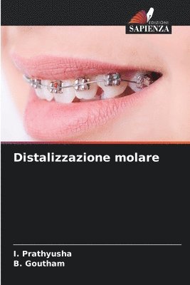 Distalizzazione molare 1