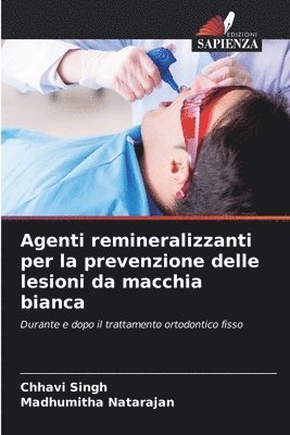 Agenti remineralizzanti per la prevenzione delle lesioni da macchia bianca 1