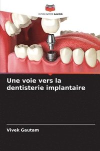 bokomslag Une voie vers la dentisterie implantaire