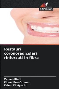 bokomslag Restauri coronoradicolari rinforzati in fibra