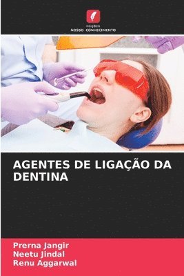 bokomslag Agentes de Ligação Da Dentina