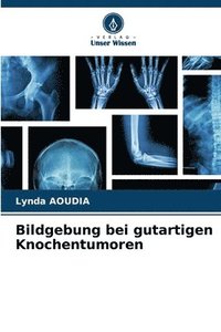 bokomslag Bildgebung bei gutartigen Knochentumoren