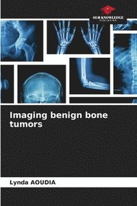 bokomslag Imaging benign bone tumors