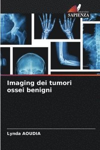 bokomslag Imaging dei tumori ossei benigni