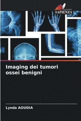 bokomslag Imaging dei tumori ossei benigni