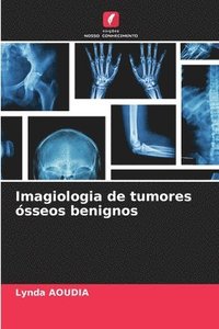 bokomslag Imagiologia de tumores sseos benignos