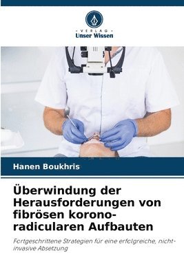 bokomslag berwindung der Herausforderungen von fibrsen korono-radicularen Aufbauten