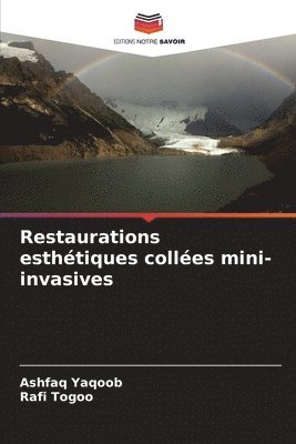 bokomslag Restaurations esthtiques colles mini-invasives