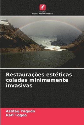 Restauraes estticas coladas minimamente invasivas 1