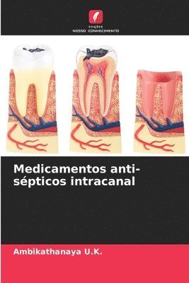 bokomslag Medicamentos anti-spticos intracanal