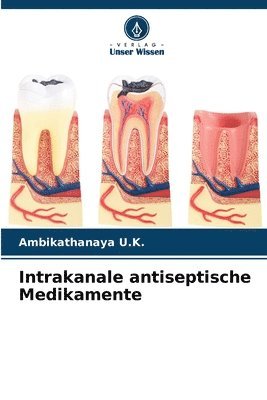 bokomslag Intrakanale antiseptische Medikamente