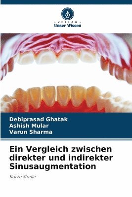 Ein Vergleich zwischen direkter und indirekter Sinusaugmentation 1