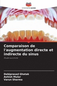 bokomslag Comparaison de l'augmentation directe et indirecte du sinus