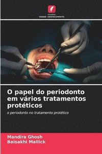 bokomslag O papel do periodonto em vrios tratamentos protticos