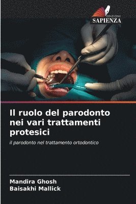 Il ruolo del parodonto nei vari trattamenti protesici 1