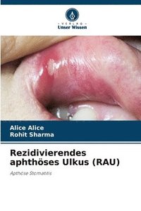 bokomslag Rezidivierendes aphthses Ulkus (RAU)