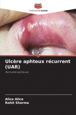 bokomslag Ulcre aphteux rcurrent (UAR)