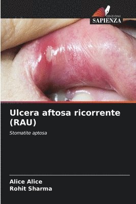 Ulcera aftosa ricorrente (RAU) 1
