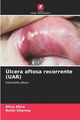 lcera aftosa recorrente (UAR) 1