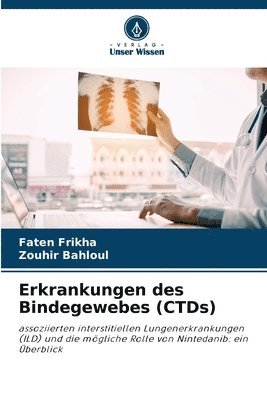 bokomslag Erkrankungen des Bindegewebes (CTDs)