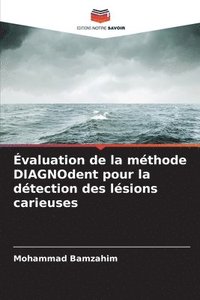 bokomslag valuation de la mthode DIAGNOdent pour la dtection des lsions carieuses