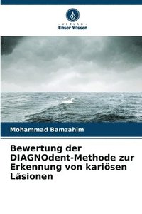 bokomslag Bewertung der DIAGNOdent-Methode zur Erkennung von karisen Lsionen