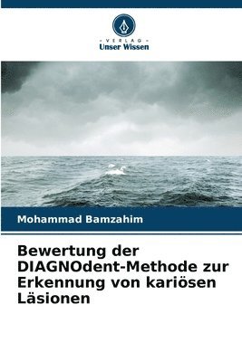 Bewertung der DIAGNOdent-Methode zur Erkennung von karisen Lsionen 1