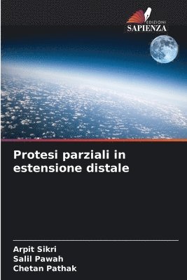 bokomslag Protesi parziali in estensione distale