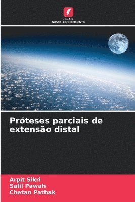 bokomslag Prteses parciais de extenso distal