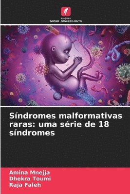 Sndromes malformativas raras 1