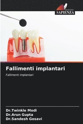 bokomslag Fallimenti implantari