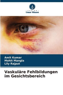 bokomslag Vaskulre Fehlbildungen im Gesichtsbereich