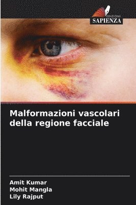 Malformazioni vascolari della regione facciale 1
