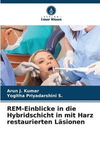 bokomslag REM-Einblicke in die Hybridschicht in mit Harz restaurierten Lsionen