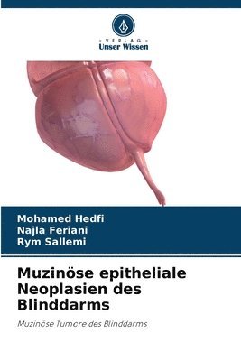 Muzinse epitheliale Neoplasien des Blinddarms 1