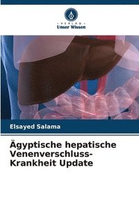 bokomslag gyptische hepatische Venenverschluss-Krankheit Update