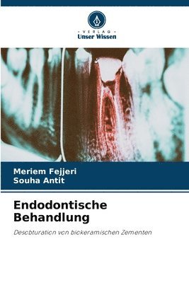 bokomslag Endodontische Behandlung