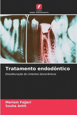 Tratamento endodntico 1