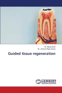 bokomslag Guided tissue regeneration