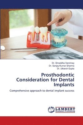 Prosthodontic Consideration for Dental Implants 1