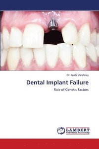 bokomslag Dental Implant Failure