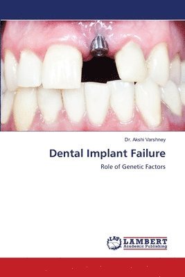 Dental Implant Failure 1