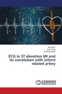 bokomslag ECG in ST elevation MI and its correlation with infarct related artery